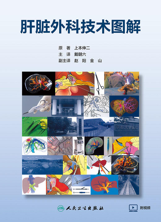 肝脏外科技术图解 2022年7月参考书 9787117330107 商品图1