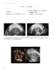 妇产超声造影图鉴 中国医师协会超声医师分会超声造影图鉴丛书 聂芳 谢红宁 妇科临床造影病例 人民卫生出版社9787117330602 商品缩略图4