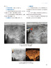 浅表器官超声造影图鉴 中国医师协会超声医师分会超声造影图鉴丛书 罗渝昆 罗葆明 临床造影病例人民卫生出版社9787117330466 商品缩略图4
