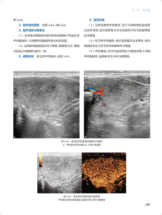 浅表器官超声造影图鉴 中国医师协会超声医师分会超声造影图鉴丛书 罗渝昆 罗葆明 临床造影病例人民卫生出版社9787117330466 商品图4