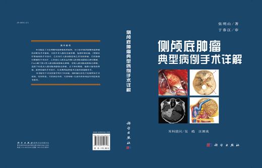 新书推荐《侧颅底肿瘤典型病例手术详解》，于春江教授主审，张明山教授主编 商品图2