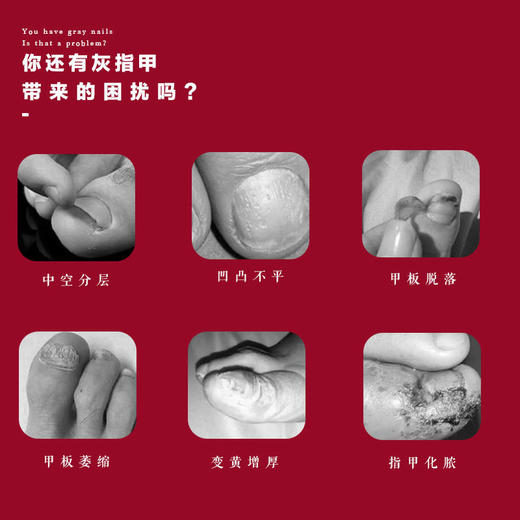 【第2瓶半价】北京同仁堂灰指甲液草本消菌长久防护有效祛灰甲温和修复不伤甲操作方便 商品图1