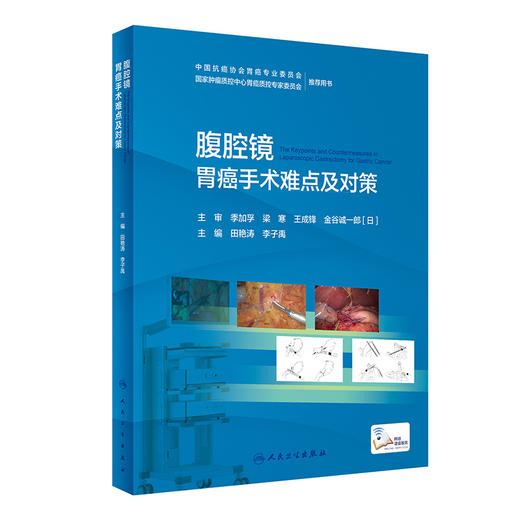 腹腔镜胃癌手术难点及对策 2022年8月参考书 9787117330770 商品图0