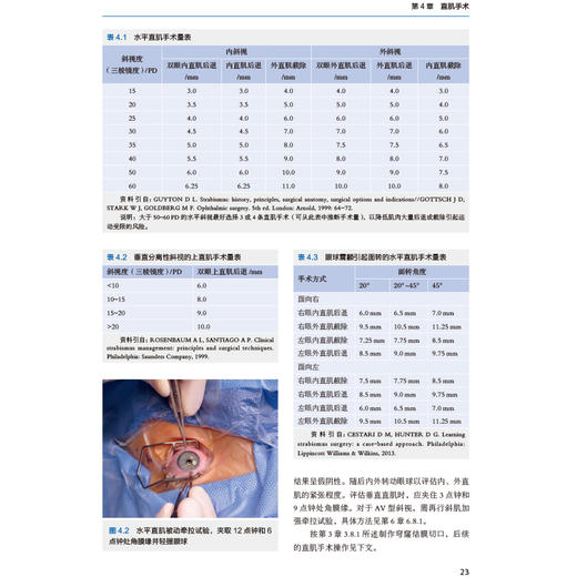 小儿眼科手术操作与规程----要点与技巧（精） 商品图4