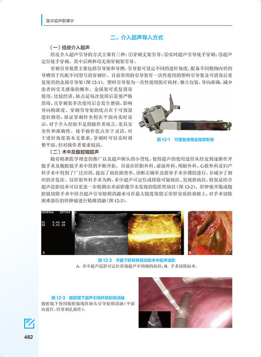 医学超声影像学 第3版 十四五规划教材 全国高等学校教材 供医学影像学专业用 梁萍 冉海涛 人民卫生出版社9787117331920 商品图4