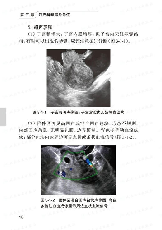现货 超声危急值管理手册 姜玉新 李建初 危急疾病的标准化检查流程和诊断超声危急值报告制度及流程 人民卫生出版社9787117333559 商品图4