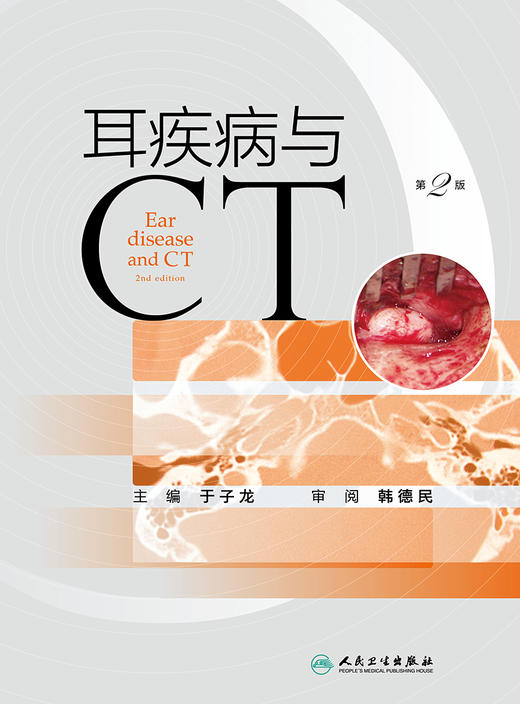 耳疾病与CT（第2版）2022年8月参考书 9787117331869 商品图1