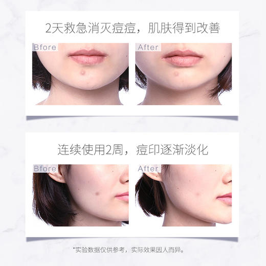 【2支装】法国SAMPAR祛痘笔植物精华液  多重植萃原力  无添加~ 商品图4