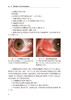 眼科手术相关性角结膜病变眼表疾病临床系列 白内障 青光眼手术相关性角结膜病变 贾卉 孙旭光编9787117331203人民卫生出版社 商品缩略图4