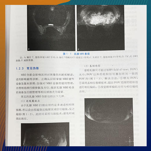 现代体部磁共振诊断学：乳腺分册 商品图5