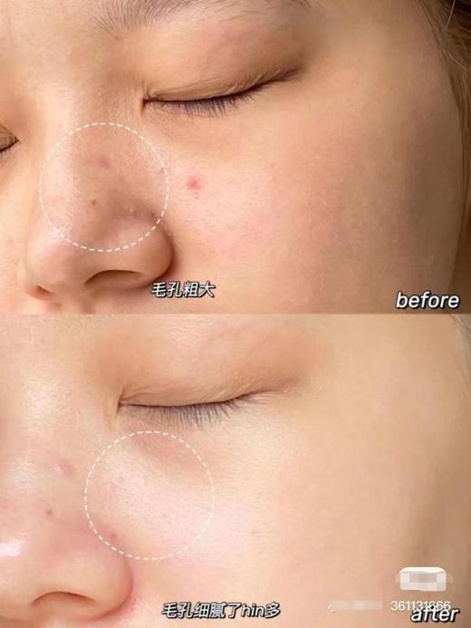 【清仓好价】城野医生橙胖子磨皮滤镜精华40ml（23.10） 商品图2