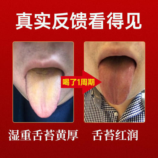北京同仁堂内廷上用伏湿膏180g 商品图2