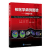 核医学病例图谱 肿瘤分册 付占立 何作祥 主编 核医学肿瘤病案分析图谱汇编 PET/CT影像诊断临床 北京大学医学出版社9787565926273 商品缩略图1