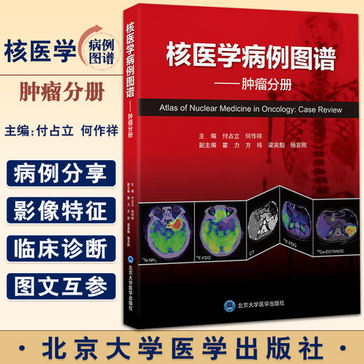 核医学病例图谱 肿瘤分册 付占立 何作祥 主编 核医学肿瘤病案分析图谱汇编 PET/CT影像诊断临床 北京大学医学出版社9787565926273 商品图0