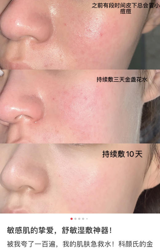 科颜氏金盏花爽肤水（微信询价） 商品图1