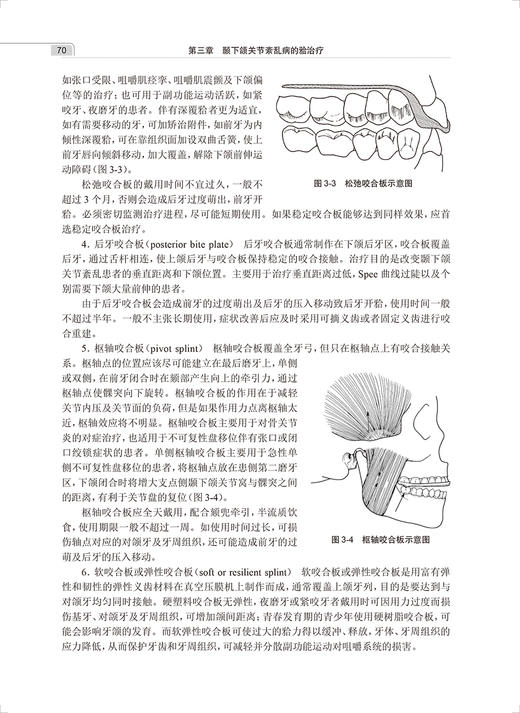 颞下颌关节紊乱病临床诊疗解析 梁新华 李晓箐 主编 口腔科学口腔修复正畸牙合治疗影像学检查 人民卫生出版社9787117333016 商品图4