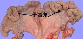  常艾灸清理子宫，很多妇科方面的烦恼都能避免！子宫不排毒，便成“垃圾场”！ 