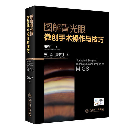 图解青光眼微创手术操作与技巧 张秀兰 著 眼科学书籍青光眼微创手术操作视频并发症处理 人民卫生出版社9787117332927 商品图1