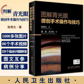 图解青光眼微创手术操作与技巧 张秀兰 著 眼科学书籍青光眼微创手术操作视频并发症处理 人民卫生出版社9787117332927
