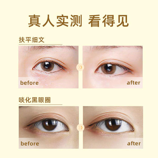 Sundari桑德丽眼油洋甘菊眼部精油10ml/瓶 淡化细纹黑眼圈按摩精华油 商品图4