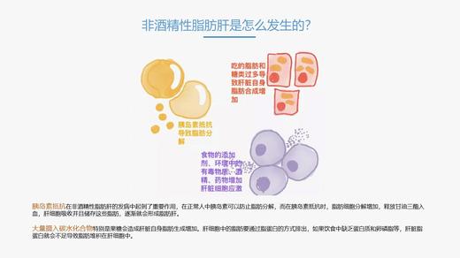 均衡膳食3  脂肪肝的应对策略 商品图0