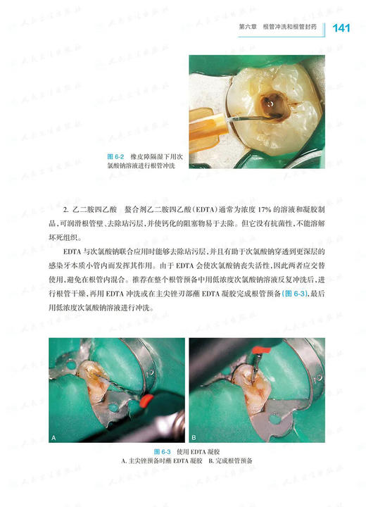 正版现货 根管治疗图谱 第2版 彭彬口腔临床操作技术丛书 根管治疗标准程序临床操作视频牙体牙髓病根尖周病人民卫生出版9787117333641 商品图4