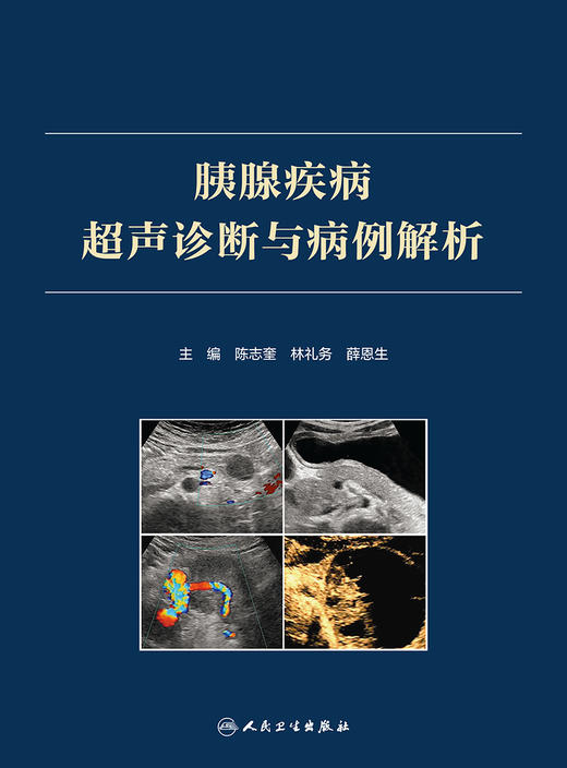 胰腺疾病超声诊断与病例解析 2022年8月参考书 9787117330794 商品图1