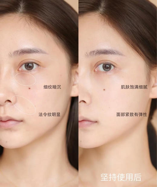 【清仓好价】佰诺佰琪焕颜新生爽肤水120ml+乳液100ml（23.6） 商品图2