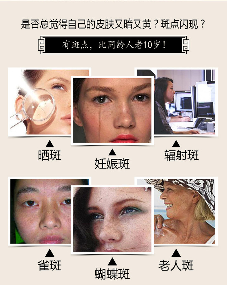 美白祛斑霜_05