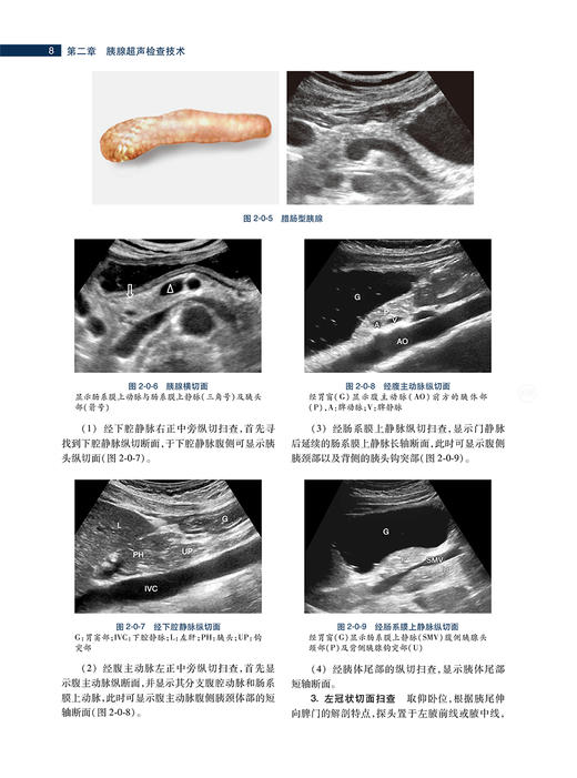 正版 胰腺疾病超声诊断与病例解析 陈志奎林礼务薛恩生主编 胰腺疾病病因病理临床特点超声诊断 人民卫生出版社9787117330794 商品图4
