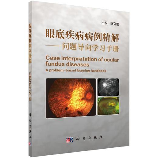 眼底疾病病例精解——问题导向学习手册/陈有信 商品图0