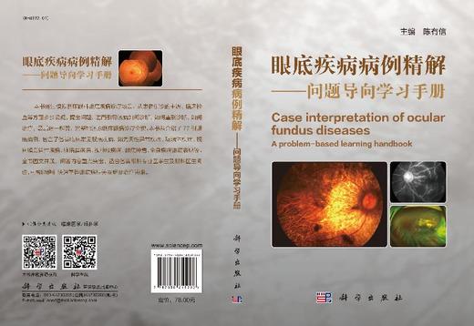 眼底疾病病例精解——问题导向学习手册/陈有信 商品图3