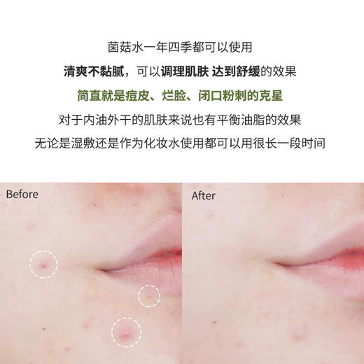 悦木之源10倍灵芝水菌菇水爽肤水30ml/50ml /100ml油痘肌控油中样湿敷修复去闭口 商品图3