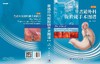 普通外科腹腔镜手术图谱（第2版）/王存川 商品缩略图3
