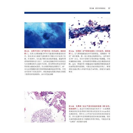 肺细胞与组织病理学图谱 商品图2