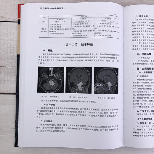 神经外科疾病全病程管理 商品图8