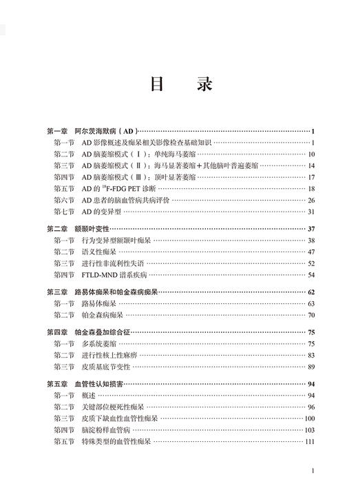 实用痴呆神经影像图谱 郑东明编著 痴呆相关疾病神经影像特点阅片思路注意事项 北京大学医学出版社9787565926143 商品图4