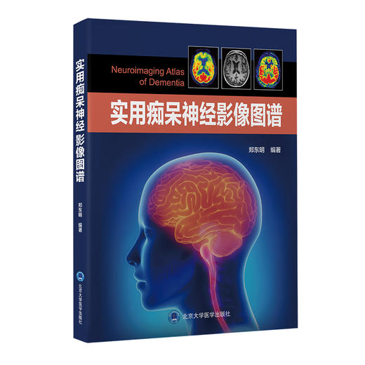 实用痴呆神经影像图谱 郑东明编著 痴呆相关疾病神经影像特点阅片思路注意事项 北京大学医学出版社9787565926143 商品图1