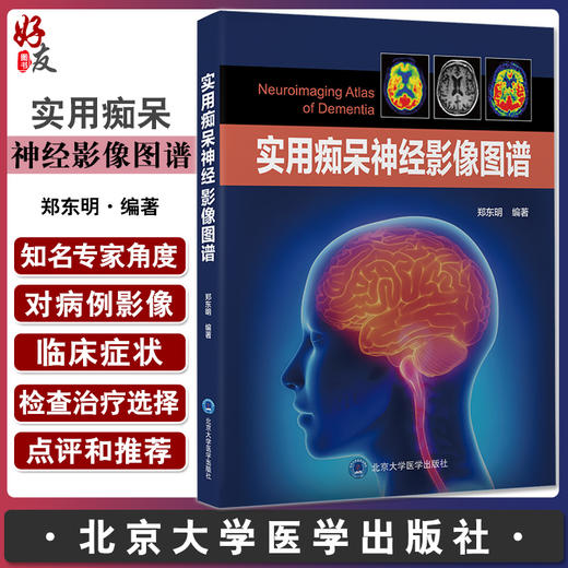 实用痴呆神经影像图谱 郑东明编著 痴呆相关疾病神经影像特点阅片思路注意事项 北京大学医学出版社9787565926143 商品图0