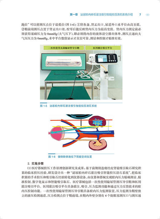 尿路结石智能控压腔内碎石取石术 宋乐明 智能控制肾盂内压腔内碎石吸引取石各术式操作步骤 人民卫生出版社9787117334181 商品图4