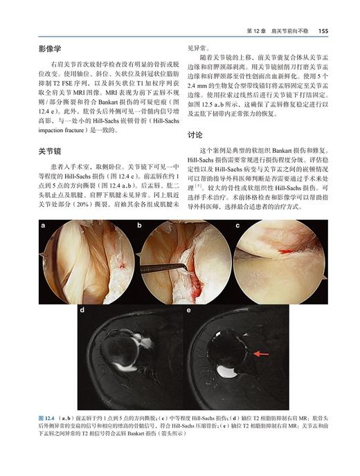 关节磁共振成像与关节镜图谱 雷光华 肖文峰 骨科运动医学膝关节肩关节肘关节髋关节疾病外科 北京大学医学出版社9787565923609 商品图4