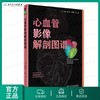 [旗舰店 现货]心血管影像解剖图谱 马小静 何亚峰 陈鑫 主编 9787117254991 影像医学 2018年5月参考书 人民卫生出版社 商品缩略图0