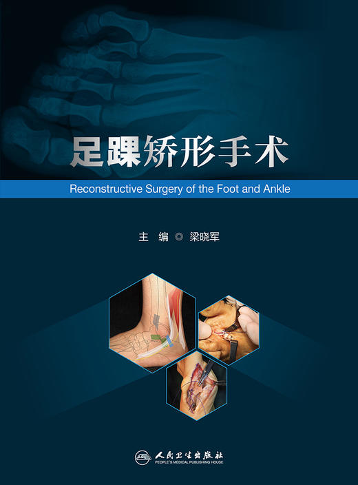 足踝矫形手术 2022年9月参考书 9787117332699 商品图1