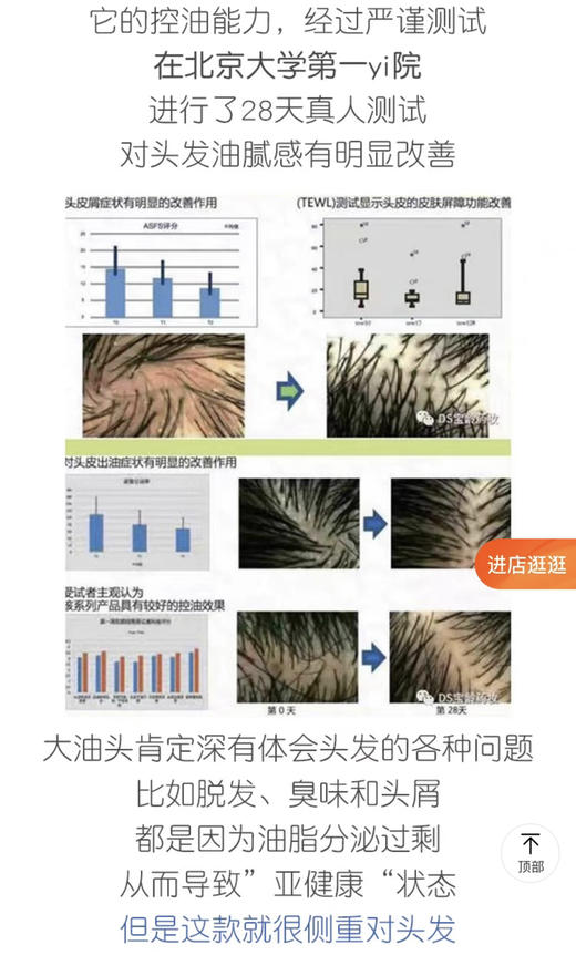 宝龄洗发水头皮发根洁净液300ml大瓶性价比高中药成分防脱医院款何首乌 商品图13