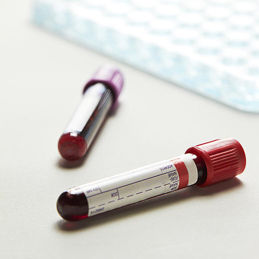 凝血四项 商品图0