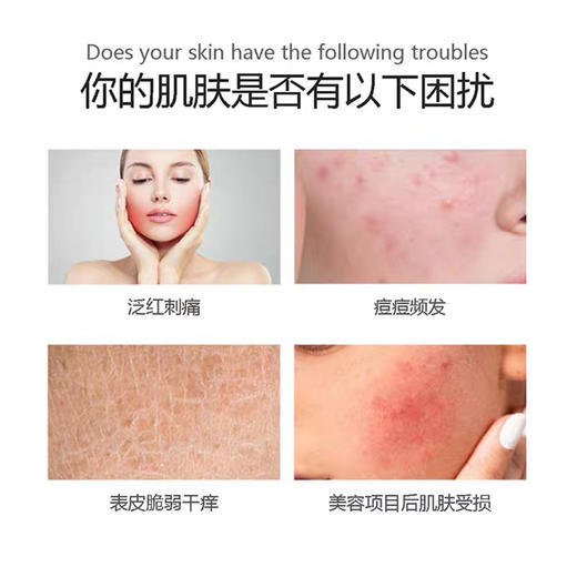 科优妍表皮修护液医院款激光水光微针修复喷剂敷料 美容项目术后修复肌肤屏障egf成分25000活性 商品图10