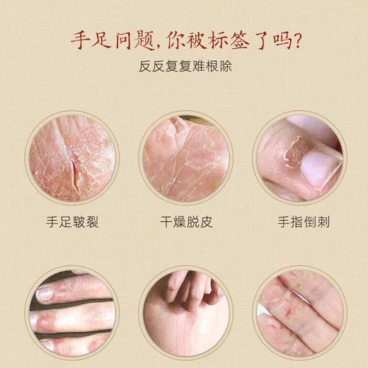 仁和匠心皲裂膏护手霜防龟裂干裂脚裂手足滋润膏 商品图1