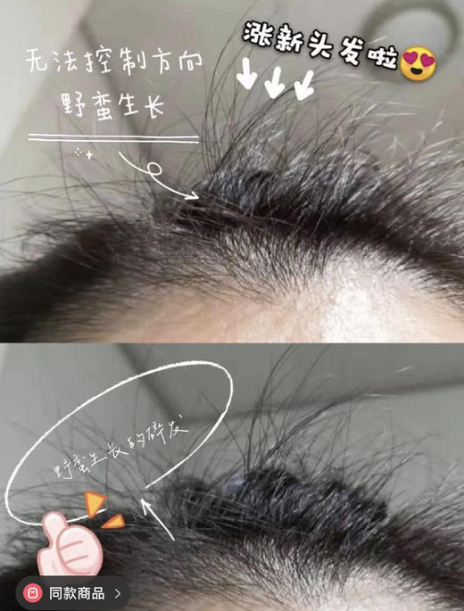 【99选2】德国朴兰图21咖啡因掉发滋养洗发露250ml（ 白色款/绿色加强款）（22.12）/咖啡因防脱育发精华200ml（22.12） 商品图2