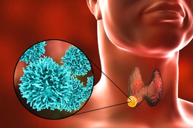 注意！结节的这几个危害，最严重会导致窒息：