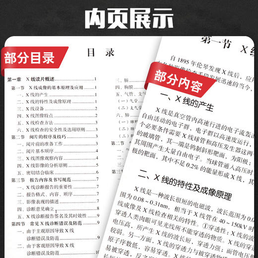 Z包邮正版X线读片指南 精装 临床影像诊断丛书 x线检查书籍鉴别诊断图书放射诊断学系列临床影像读片入门书籍北京大学医学出版社 商品图4